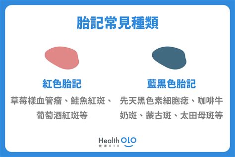 左手臂胎記|胎記怎麼產生、何時消除？醫師剖析胎記種類、胎記寓意